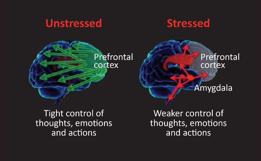 Neurofeedback Training for Burnout